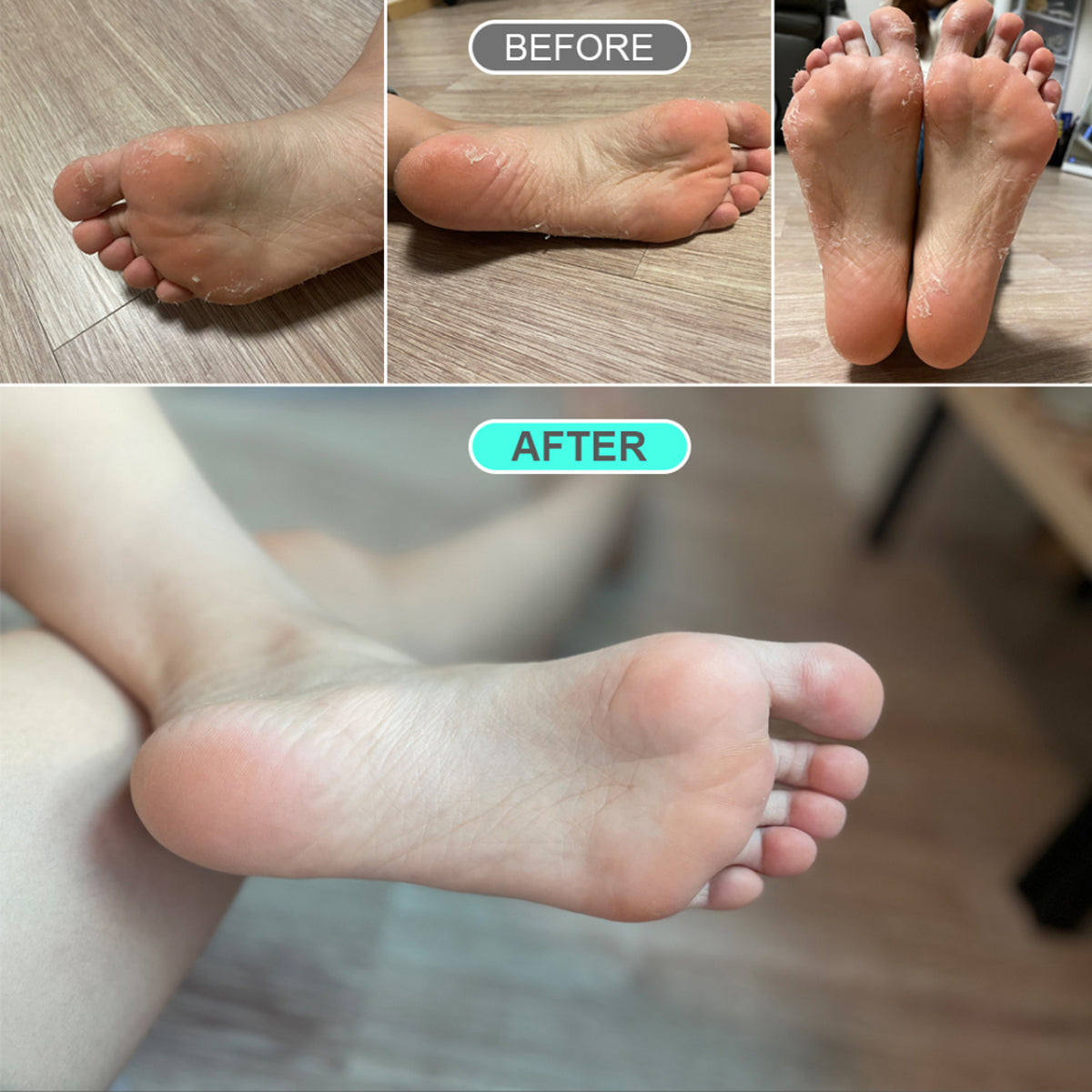 Before & After Feet Mask Result